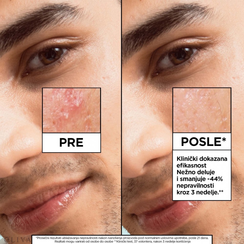 Garnier Pure Active Salicylic Serum 30 Ml