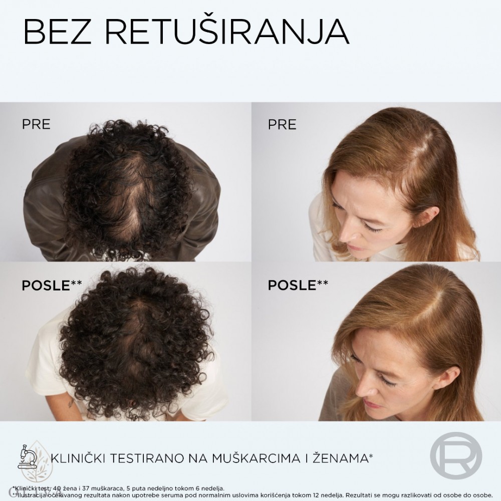 L’oreal Paris Elseve Growth Booster Šampon 200 Ml